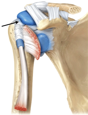 The line is pointing to the _____ ligament.   A) coracoacromial B) acromioclavicular C) glenohumeral D) coracohumeral