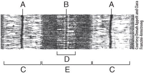 In the diagram,where are thick filaments found?   A) C B) E C) A D) B E) All of these choices