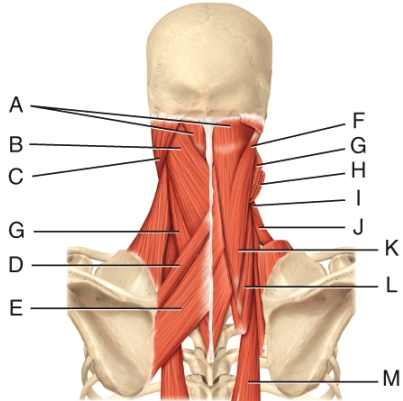 Where is the levator scapulae?   A) H B) F C) I D) L E) A