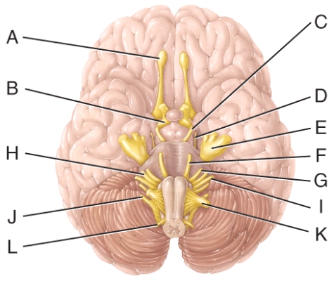 Which cranial nerve in the diagram is involved with speech and swallowing and has a purely motor function?   A) H B) I C) J D) K E) L