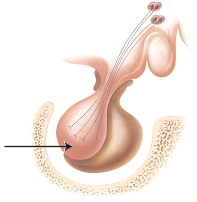 Which of the following conditions could potentially result from hyposecretion of a hormone released by the portion of the marked gland in the diagram?   A) tetany B) acromegaly C) diabetes insipidus D) goiter E) Cushing's syndrome