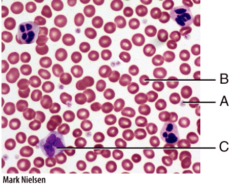 Which labeled cell in the diagram is a WBC?   A) A B) B C) C D) Both B and C E) All of these choices