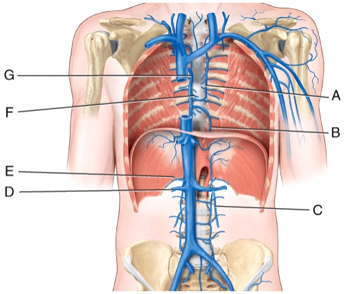 Which vessel in the figure is labeled G ? A) accessory hemiazygos vein B) hemiazygos vein C) right suprarenal vein D) pericardial vein E) azygos vein