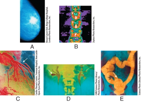 Which radiographs were obtained using low-dose x-rays?   A) (A) and (B)  B) (B) and (C)  C) (C) and (D)  D) (A) and (C)  E) (B) and (E) 