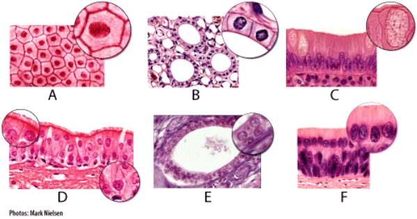 Which of the light micrographs in the figure below can be found in serous membranes?   A) A B) B C) C D) D E) E