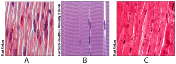 In the figure shown,which light micrograph contains autorhytmic cells?   A) A B) B C) C