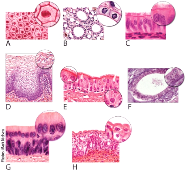 Which of the light micrographs in the following figure shows the type of epithelial tissue whose structure allows it to be stretched or distended?   A) A B) D C) E D) G E) H