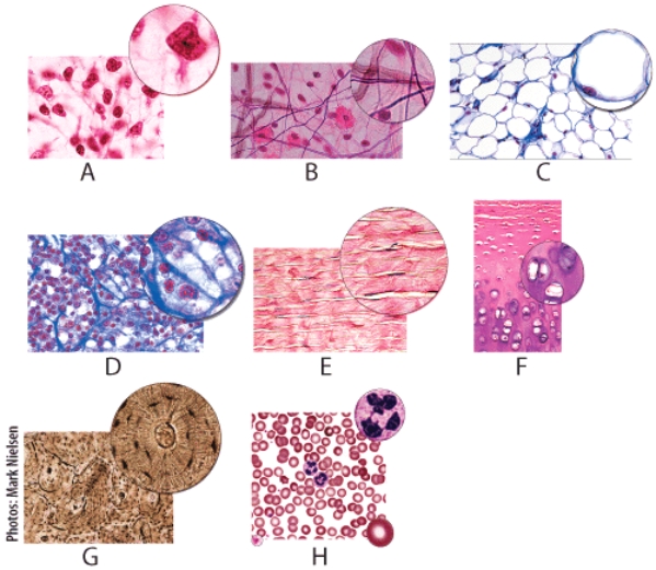 Which figure shows tissue that is found in the trachea?   A) B B) C C) E D) F E) G