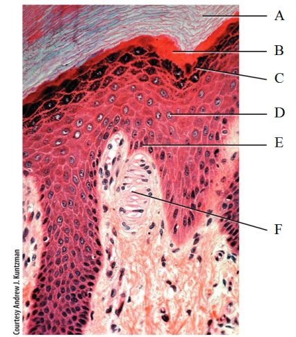 In the photomicrograph shown below,which layer will contain melanocyte projections,keratinocytes and intraepidermal macrophages (Langerhan cells) ?   A) A B) B C) C D) D E) E