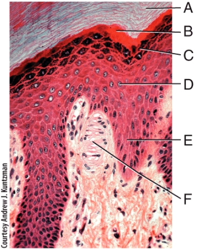 In the photomicrograph shown below,which layer is only seen in thick skin?   A) A B) B C) C D) D E) E