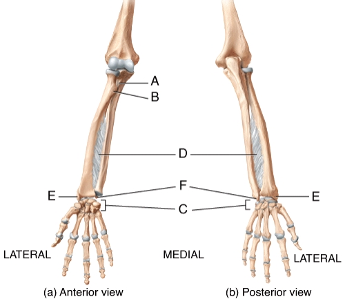 In the diagram,where is the styloid process of the radius?   A) A B) B C) E D) F E) Not labeled on the diagram.