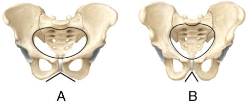 Which pelvis in the diagram shows the characteristics of a female pelvis?   A) A B) B C) Both are male