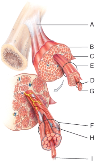 On the diagram,which layer is composed of dense irregular and surrounds a muscle?   A) A B) B C) C D) D E) E