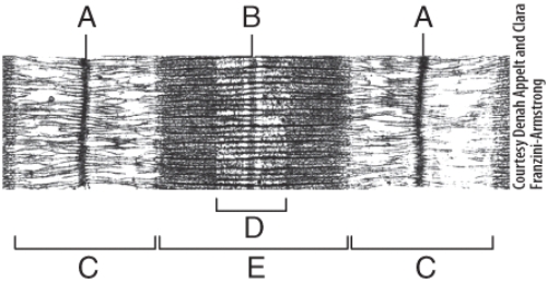 In the diagram,what area is composed of only thick filaments?   A) C B) E C) A D) B E) D