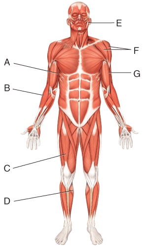 Which muscle in this figure produces the effort when you plantar flex to see over a taller person in front of your view??   A) C B) D C) G D) H E) I