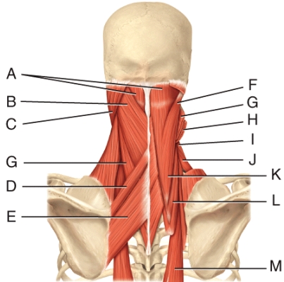 Which Muscle in This Figure is Innervated by a Cranial | Biology+