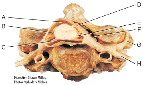 Which of the labeled structures is composed of squamous to cuboidal cells and is very vascular?   A) D B) E C) F D) G E) H
