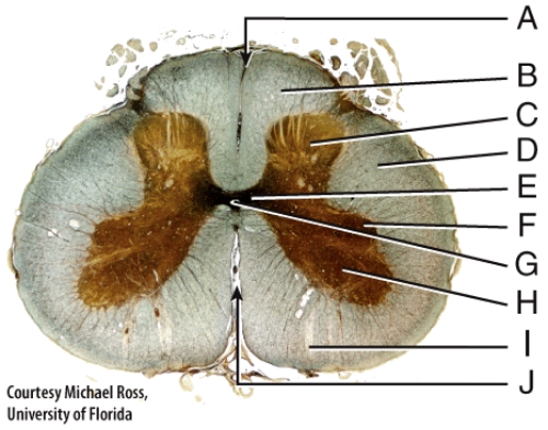 In this diagram which area is continuous with the 4<sup>th</sup> ventricle of the brain?   A) A B) B C) G D) J E) I