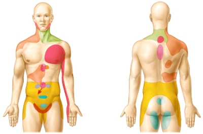 What do the colored regions on the body's surface in the diagram represent?   A) Dermatomes B) Areas of referred pain C) Regions of nociceptors D) Areas supplied by the primary somatosensory area E) Motor nuclei