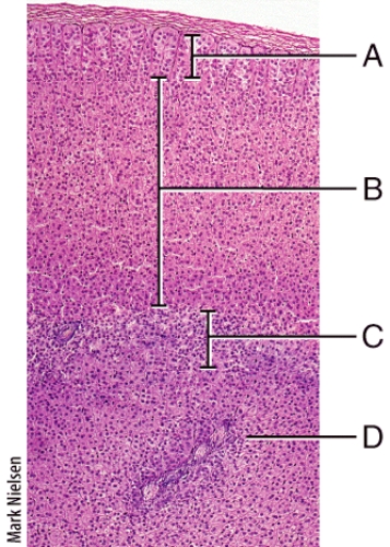 Which of the following describes a function of a hormone produced in the zone of the adrenal gland labeled B?   A) enables body to resist stressors and also increases blood glucose B) intensifies sympathetic responses in other parts of the body C) accelerates formation of glucose from glycogen (glycogenolysis)  D) stimulates growth of axillary and pubic hair E) stimulates breast development and milk secretion