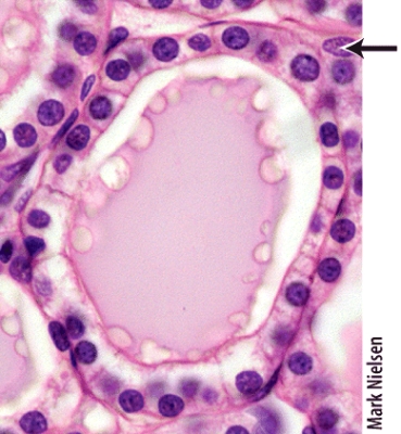 Which of the following hormones is produced by the cells marked in the thyroid follicle shown in the histology picture?   A) calcitonin B) vasopressin C) triiodothyronine (T<sub>3</sub>)  D) antidiuretic hormone (ADH)  E) calcitriol