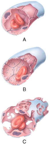 Which of the types of capillaries shown in the figure is commonly found in the kidneys,villi of the small intestine,choroid plexuses,and some endocrine glands?   A) A B) B C) C D) A and B E) B and C
