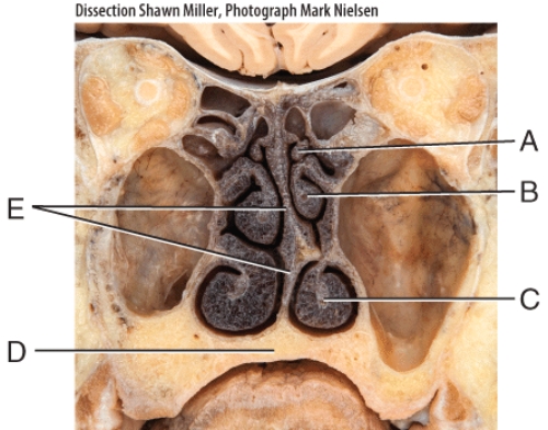 Where is the inferior nasal concha?   A) A B) B C) C D) D E) E