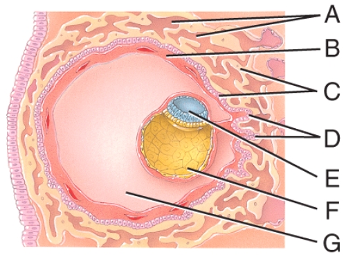 This is composed of the syncytiotrophoblast and the cytotrophoblast.   A) A B) B C) C D) D E) E