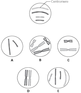 Use the following information to answer the questions below. The unlettered circle at the top of Figure 9.1 shows a diploid nucleus with four chromosomes that have not yet replicated. There are two pairs of homologous chromosomes, one long and the other short. One haploid set is black, and the other is gray. The circles labeled A-E show various combinations of these chromosomes.   Figure 9.1 -What is the correct chromosomal condition for one daughter nucleus at telophase of mitosis? A)  A B)  B C)  C D)  D E)  E