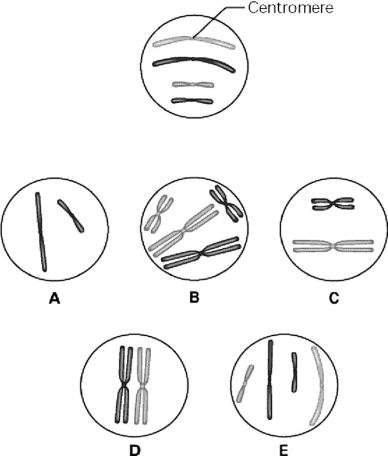 <strong>Please use the following information to answer the question(s) below. The unlettered circle at the top of Figure 9.1 shows a diploid nucleus with four chromosomes that have not yet replicated. There are two pairs of homologous chromosomes, one long and the other short. One haploid set is black, and the other is gray. The circles labeled A-E show various combinations of these chromosomes. Figure 9.1 What is the correct chromosomal condition for a nucleus at prophase of mitosis?</strong> A) A B) B C) C D) D E) E