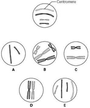 The unlettered circle at the top of the figure shows a diploid nucleus with four chromosomes that have not yet replicated. There are two pairs of homologous chromosomes, one long and the other short. One haploid set is black, and the other is grey. The circles labelled A to E show various combinations of these chromosomes.   - What is the correct chromosomal condition for one daughter nucleus at telophase of mitosis? A)  B B)  C C)  D D)  E 