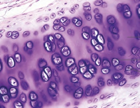   -Age related changes include all of the following EXCEPT: A)  Cell division is slower. B)  Red blood cell synthesis decreases. C)  Injury healing time is slower. D)  Collagen fibers decrease in number, yet become more flexible. E)  All of these are age related changes.