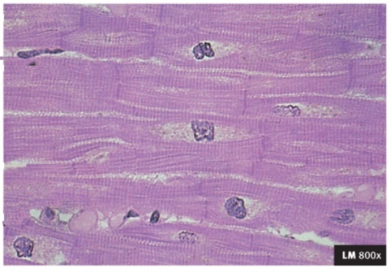   -  The type of muscle shown in the diagram is A)  cardiac B)  smooth C)  skeletal