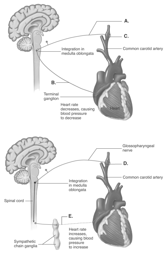 <strong> The figure illustrates the autonomic reflexes and the heart. What does A represent?</strong> A) sympathetic nerve B) increase in blood pressure detected by carotid baroreceptors C) glossopharyngeal nerve D) decrease in blood pressure detected by carotid baroreceptors E) vagus nerve