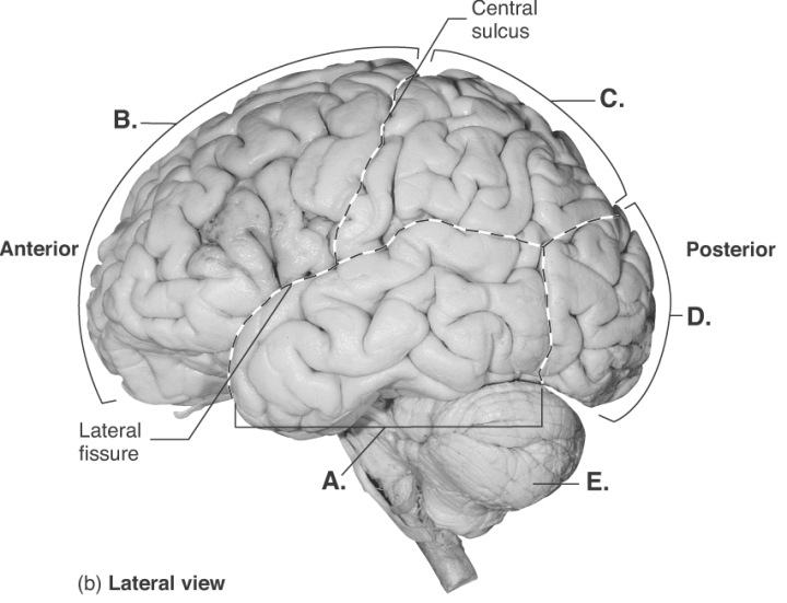   -This is a lateral view of the brain. What does  A  represent? A)  temporal lobe B)  cerebellum C)  frontal lobe D)  occipital lobe E)  parietal lobe