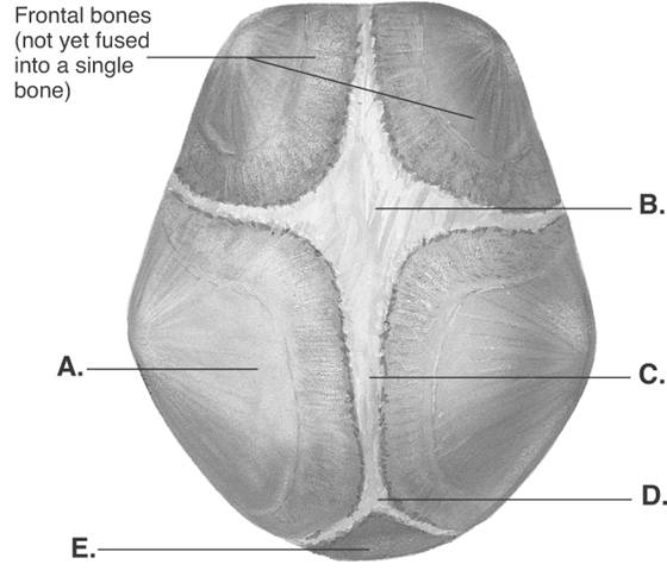   -The figure illustrates bones, fontanels, and sutures on the fetal skull. What does  A  represent? A)  anterior fontanel B)  posterior fontanel C)  parietal bone D)  sagittal suture E)  occipital bone