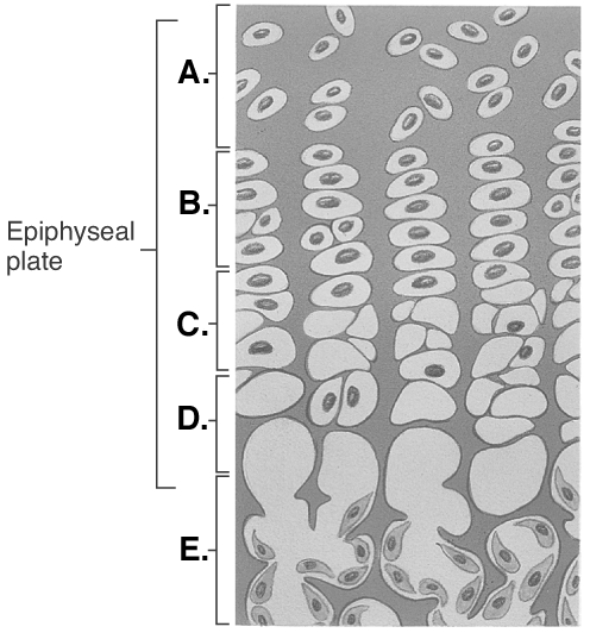   -This figure illustrates bone growth in length at the Epiphyseal Plate. What is zone  D ? A)  bone of diaphysis B)  zone of calcification C)  zone of hypertrophy D)  zone of proliferation E)  zone of resting cartilage