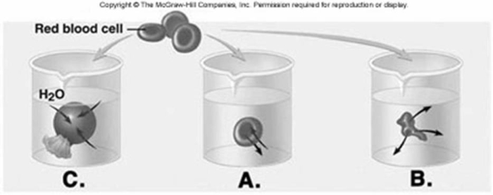   -Red blood cells (RBCs)  have been placed in three different solutions: hypotonic, hypertonic, isotonic. What is solution  A  relative to the RBC? A)  hypotonic solution B)  hypertonic solution C)  isotonic solution D)  hemolyzed E)  crenated