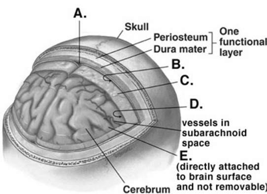   -What does  C  represent on the diagram of the skull and brain? A) subarachnoid space B) dural venous sinus C) pia mater D) arachnoid mater E) subdural space