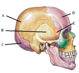   -What does structure  A  represent? A) frontal bone B) occipital bone C) parietal bone D) sphenoid bone E) temporal bone