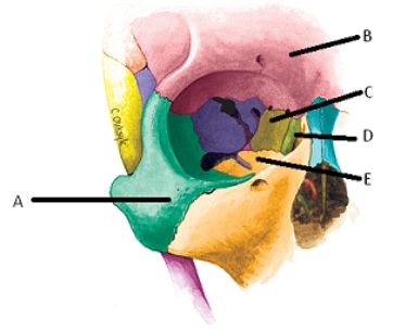   -The figure shows the bones of the right orbit.What bone does  B  represent? A) frontal B) maxilla C) zygomatic D) lacrimal E) ethmoid