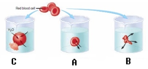   -Red blood cells (RBCs) have been placed in three different solutions: hypotonic,hypertonic,isotonic.What is solution  A  relative to the RBC? A) crenated B) hypotonic solution C) isotonic solution D) hypertonic solution E) hemolyzed