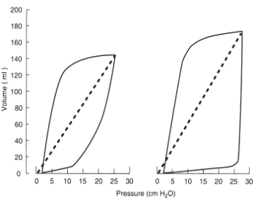 The following pressure-volume loop was obtained from a patient receiving mechanical ventilation in the pressure support mode.What type of problem does this ventilator graphic represent?   A) Insufficient flow caused by insufficient driving pressure B) Pressure sensitivity set inappropriately low C) Excessive tidal volume D) Increased mechanical dead space