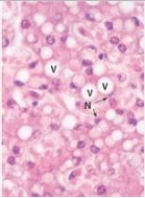 The structure designated by the  V  in the accompanying photomicrograph of liver likely contains which one of the following substances during life?   A) Air B) DNA C) Lipid D) Lysozyme E) RNA