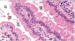 An otherwise well 24 year old woman was hiking in the mountains.She drank water from a mountain stream,but did not filter it.Two days later,she reported to an Emergency Department with intractable diarrhoea.An endoscopy biopsy of the small intestine was performed.A representative section is shown in the accompanying photomicrograph.Which one of the following infectious organisms is the most likely cause of these symptoms?   A) Candida albicans B) Cytomegalovirus (CMV)  C) Entamoeba histolytica D) Giardia lamblia E) Trichomonas vaginalis