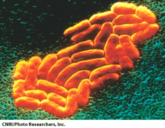 <strong>This microorganism can be observed with: </strong> A)the naked eye B)a light microscope C)a scanning electron microscope D)B and C are correct