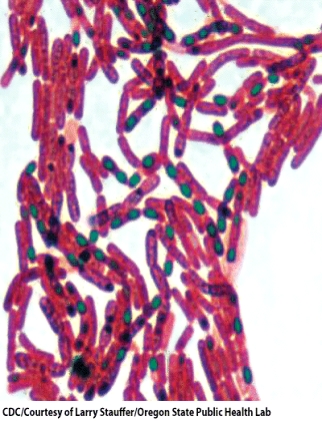 Which of the following stains has been used on this microorganism   A) Flagellar stain B) Capsule stain C) Endospore stain D) No stain
