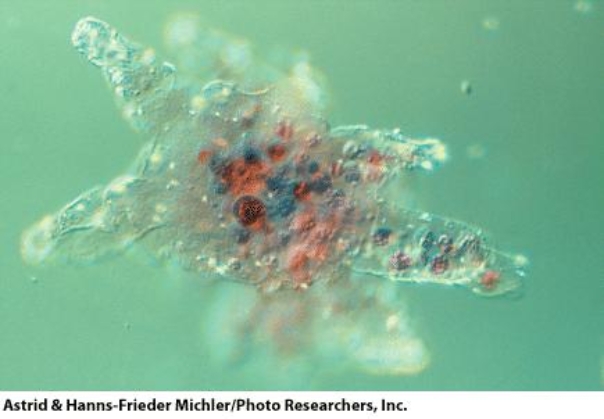 This organism moves by:   A) flagella B) cilia C) pseudopodia D) cannot move