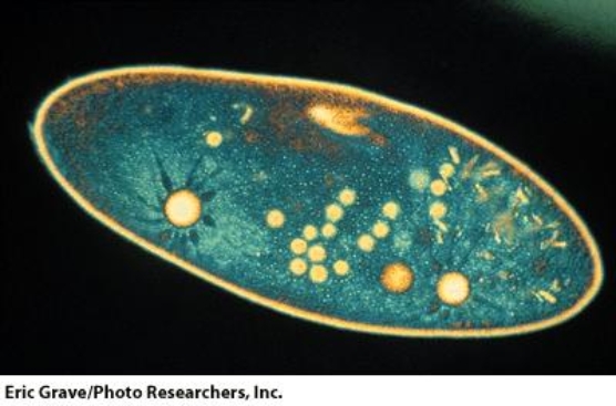 This organism moves by:   A) pseudopodia B) cilia C) flagella D) microtubules