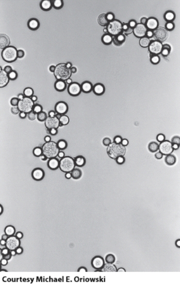 This organism belongs to the:   A) protists B) arthropods C) helminths D) fungi